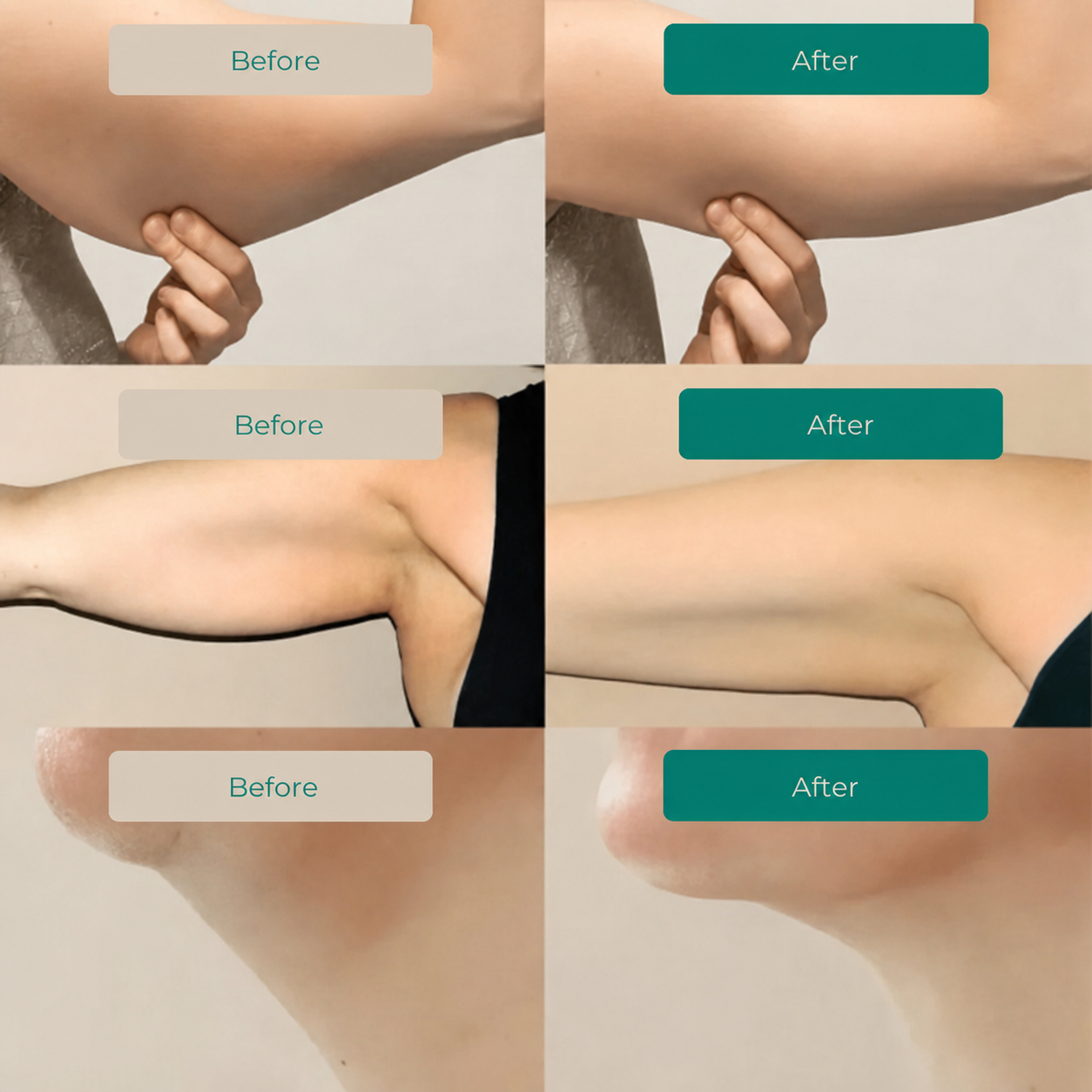 Lymphatic Drainage